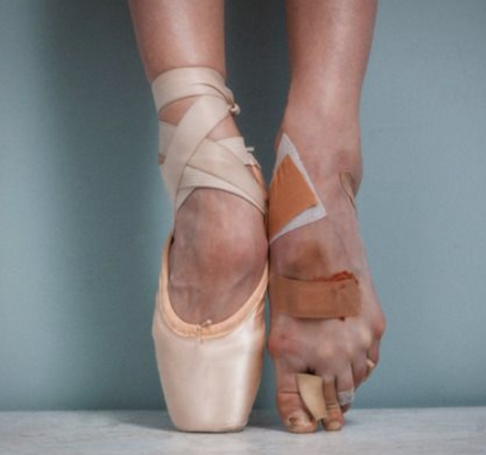 does-ballet-ruin-your-feet